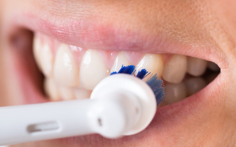 Čistenie zubov elektrickou bielou kefkou